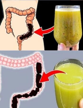 558382791 695291346936248 6538307185596837904 n Blog, Keto Recipes, Recipe Keto Eggplant Lasagna